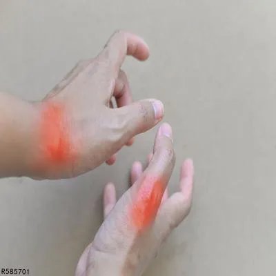 肌筋膜炎的检查方法有哪些