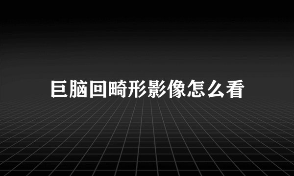 巨脑回畸形影像怎么看