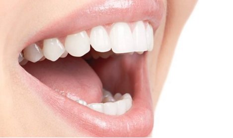 牙齿冷光美白价格多少