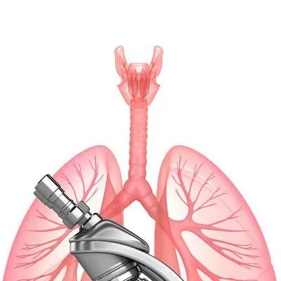 放射性肺炎有什么症状