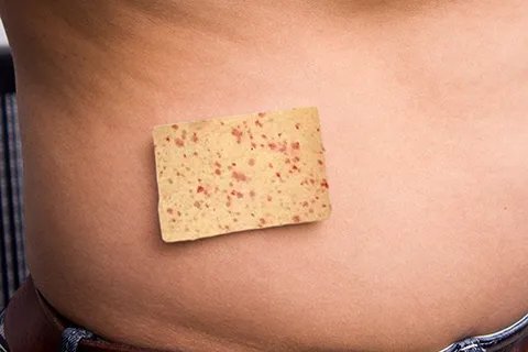 玫瑰疹是怎么引起的