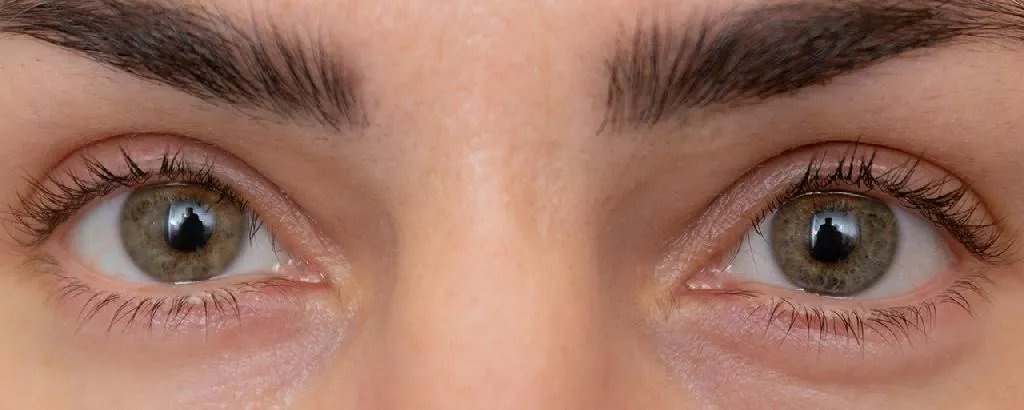 戴隐形眼镜好吗