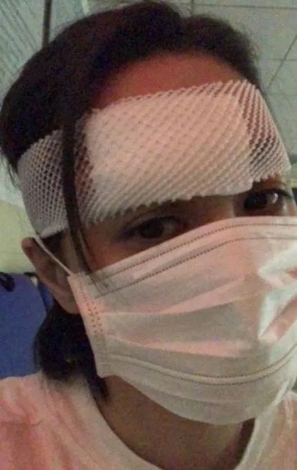 你怎么看待阿娇头受伤事件带来的后果呢?