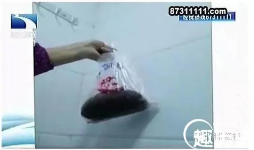 医院暗藏胎盘交易 最低价格只需25元