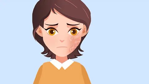 毒隐翅虫皮炎的诊断方法有哪些