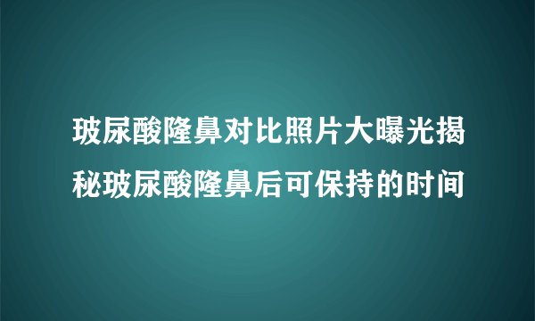 玻尿酸隆鼻对比照片大曝光揭秘玻尿酸隆鼻后可保持的时间