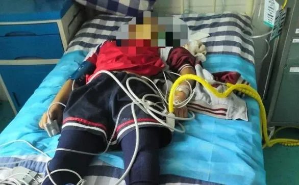 四川10岁女孩被体罚后昏迷去世，老师会负全部责任吗？