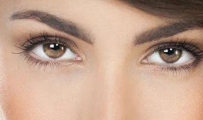 深圳去眼袋多少钱