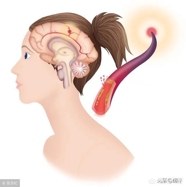 网曝刘强东妹妹因羊水栓塞去世,作为产妇“致命恶魔”的它到底有多可怕?