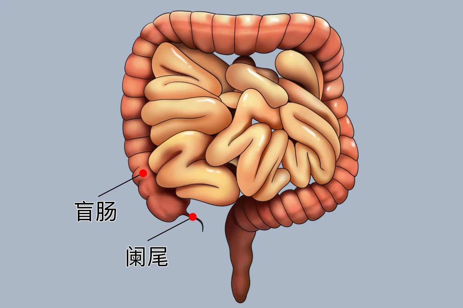 阑尾的位置图片