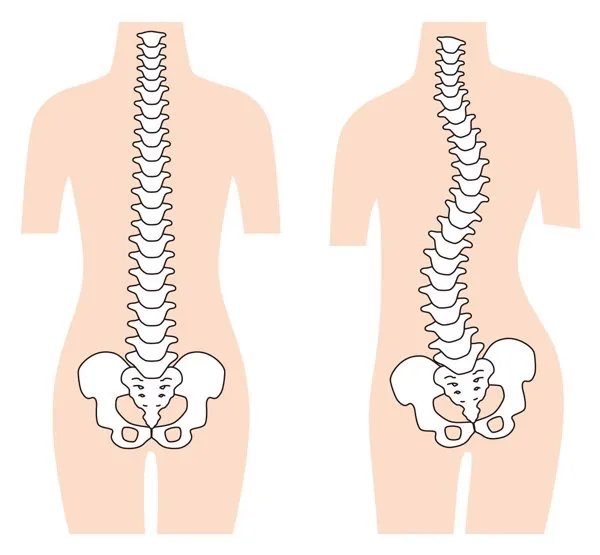 周杰伦得了强直性脊柱炎多少年了