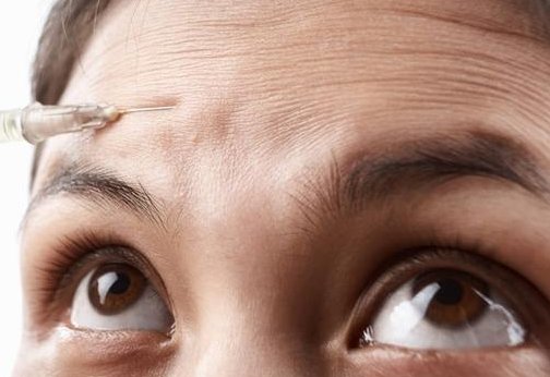 怎样可以去除抬头纹