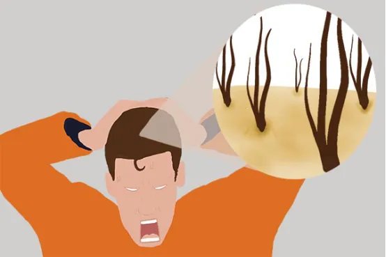 头皮发麻是怎么回事