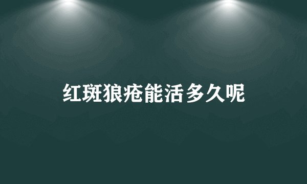 红斑狼疮能活多久呢