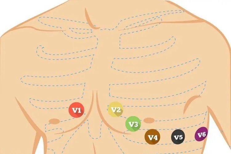 胸导联位置