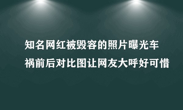 知名网红被毁容的照片曝光车祸前后对比图让网友大呼好可惜