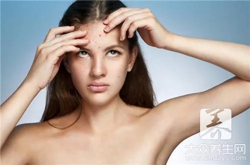 鼻翼长痘的原因