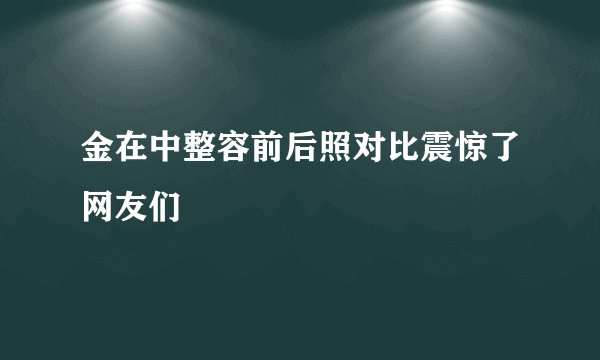 金在中整容前后照对比震惊了网友们