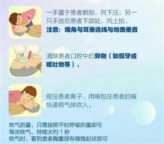 男子心跳停1小时医生持续抢救成功 完全恢复堪称奇迹