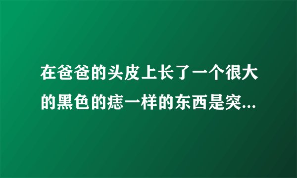 在爸爸的头皮上长了一个很大的黑色的痣一样的东西是突...