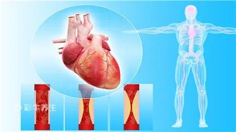 血脂高是什么原因引起的