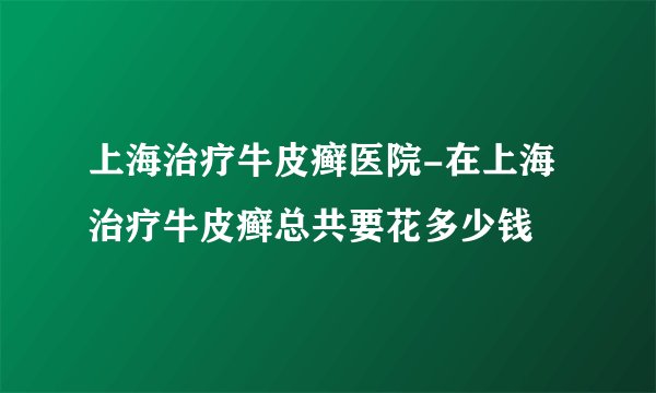 上海治疗牛皮癣医院-在上海治疗牛皮癣总共要花多少钱