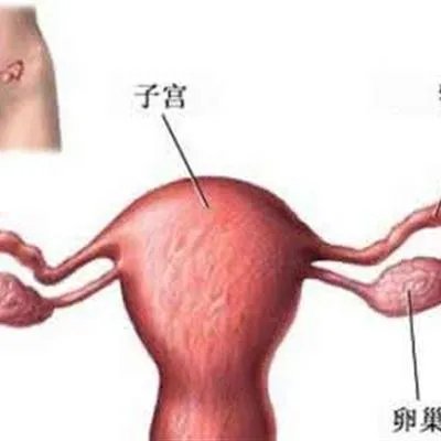 阴唇黑怎么回事?