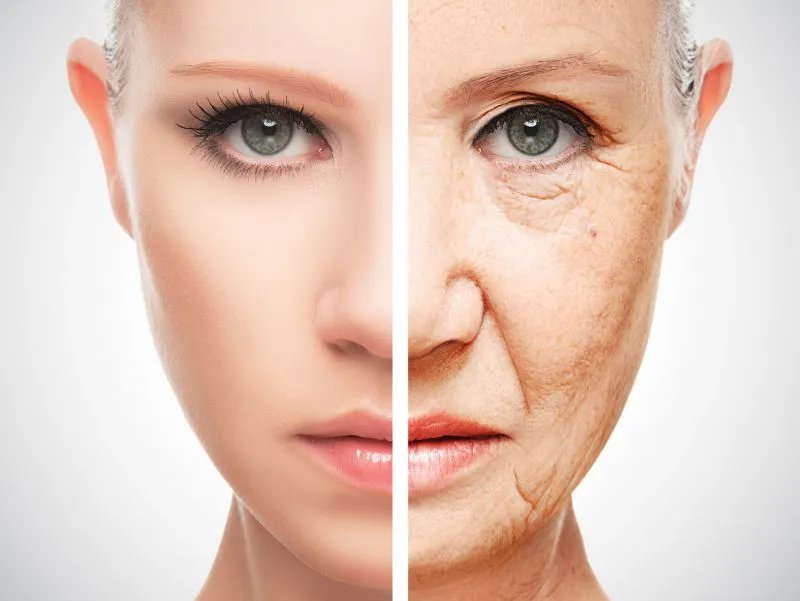 如何去掉眼角皱纹
