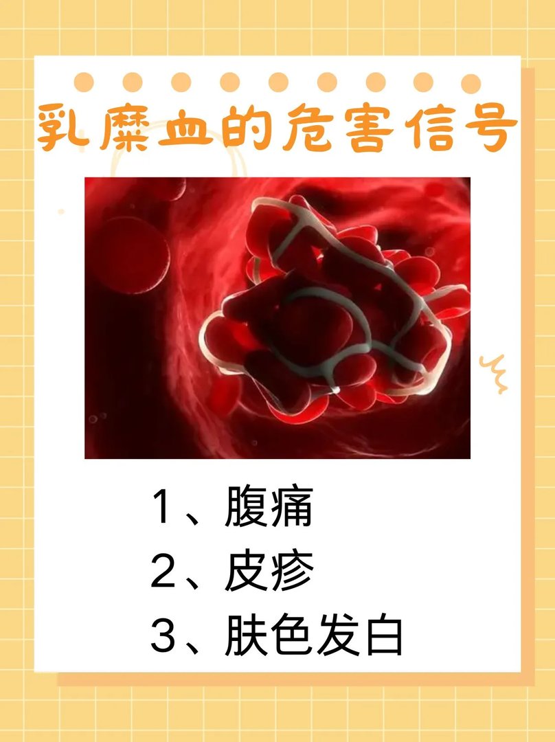 乳糜血是什么意思