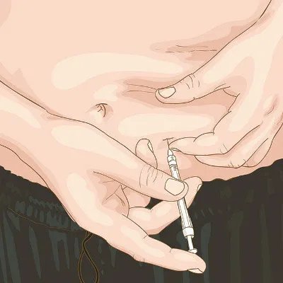 卡介苗接种反应都有什么？