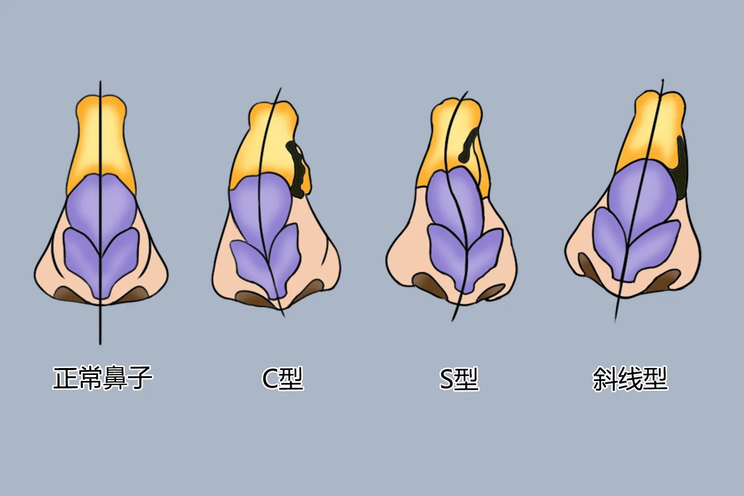 鼻子形状及图片大全