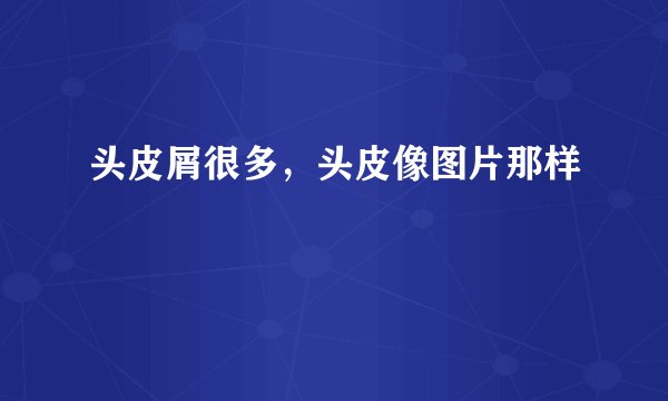 头皮屑很多，头皮像图片那样
