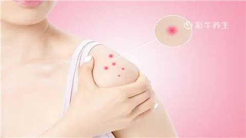 手臂上长红色的小点点是什么原因