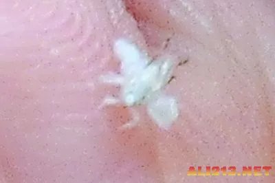 南京满天飞的“毛絮”竟是长着白毛的虫子!