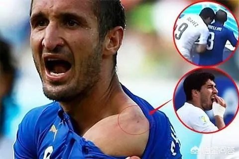 禁止咬人将加入2018世界杯规则，你怎么看？