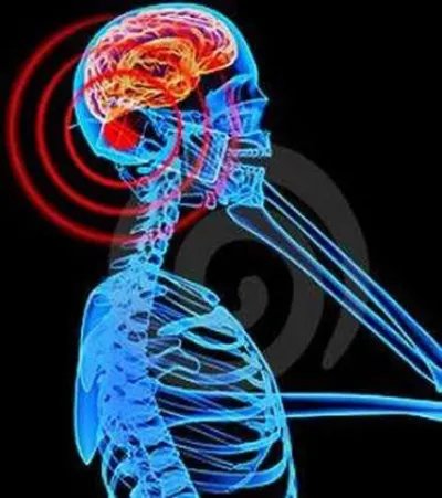 手机辐射有多致命?真相竟是这样（图）