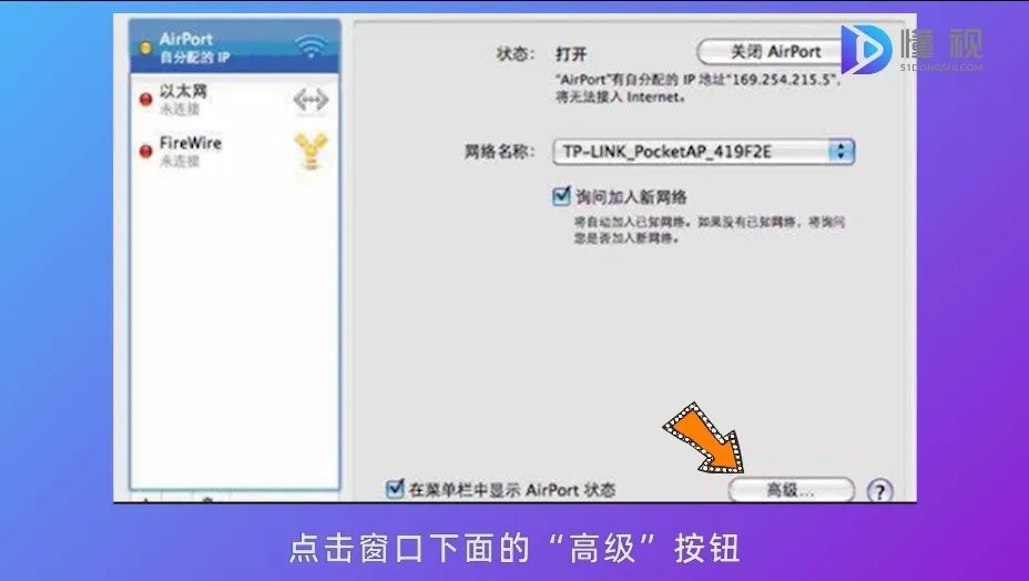 如何设置本地ip地址