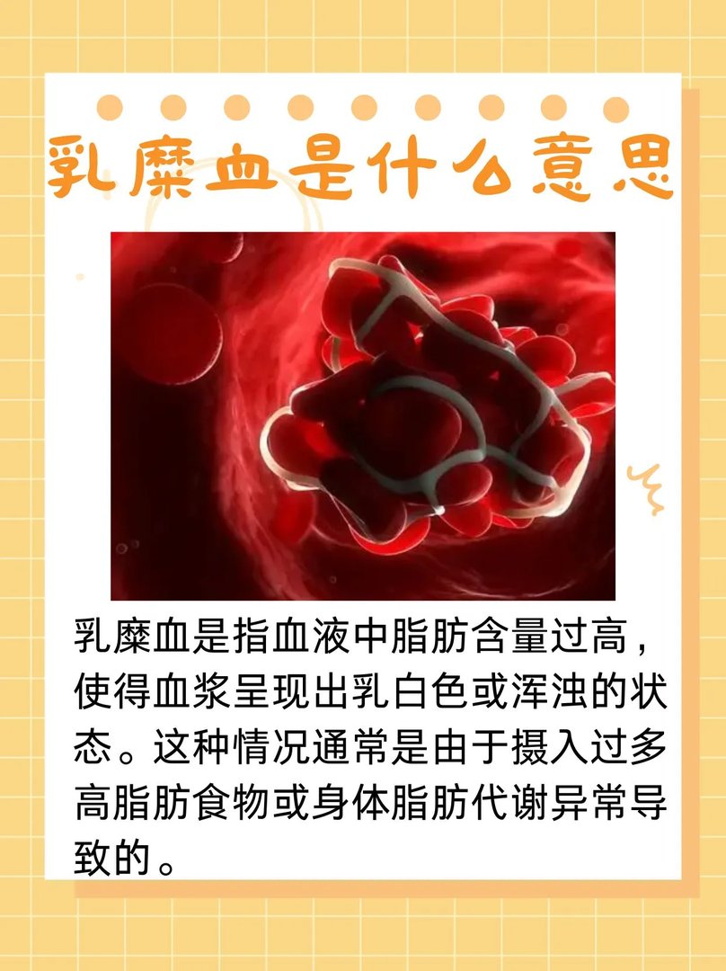 乳糜血是什么意思