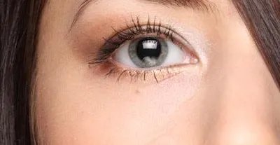 切割双眼皮是怎么做的