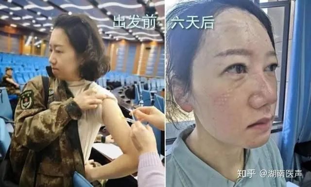 为什么美国那么多人确诊了,但是特朗普周围一直没事?
