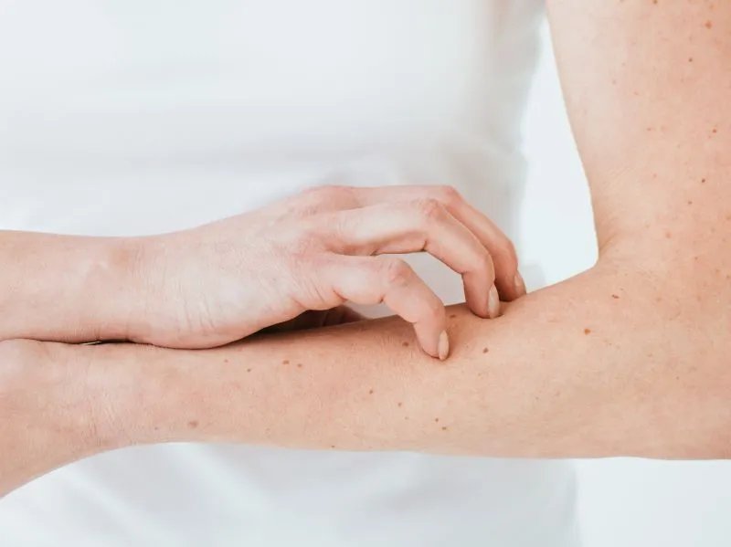 金属过敏怎么办