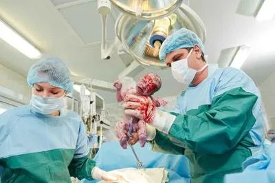 分娩镇痛仪安全吗 它的优点和缺点有这些