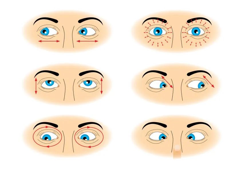 除眼袋手术方法有哪些