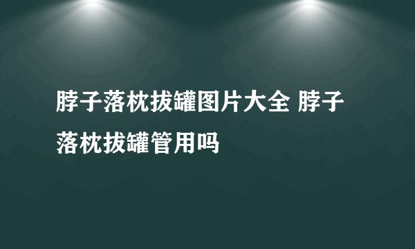 脖子落枕拔罐图片大全 脖子落枕拔罐管用吗