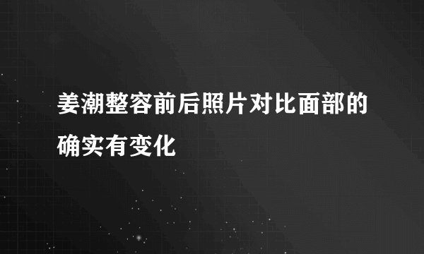 姜潮整容前后照片对比面部的确实有变化