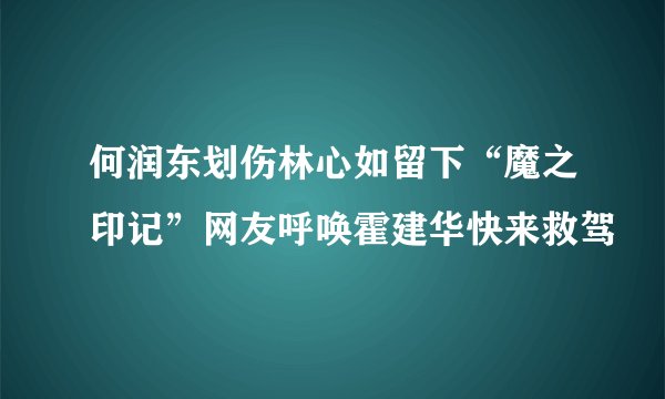 何润东划伤林心如留下“魔之印记”网友呼唤霍建华快来救驾