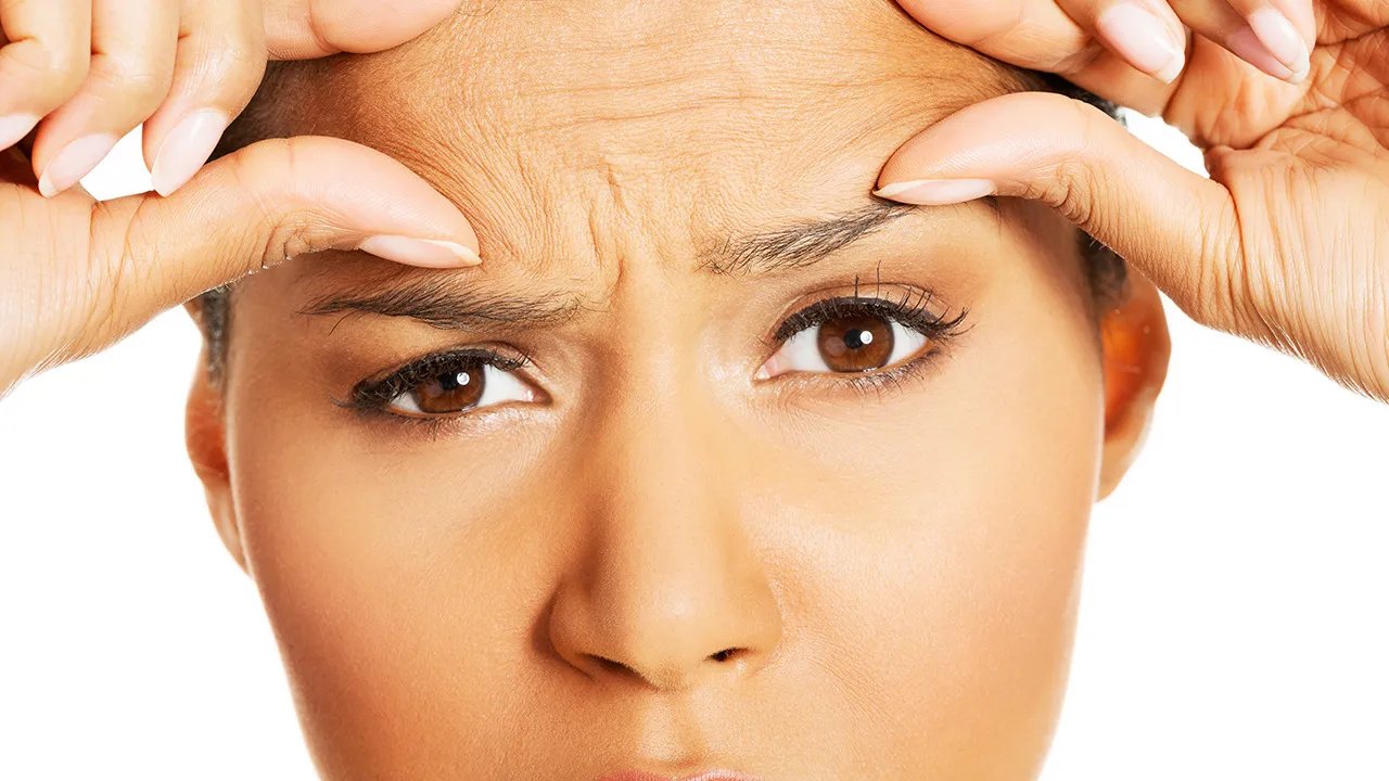 如何消除眼角皱纹