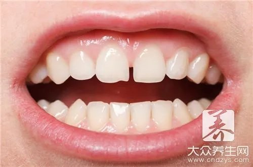 拔牙后多久可以镶牙