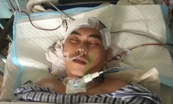 江苏男子突发脑溢血，弟弟垫付医疗费，嫂子拒绝还钱，法律上是如何规定的？