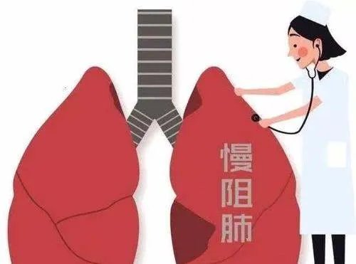 演员张少华因慢阻肺去世，此病有哪些明显的体征？